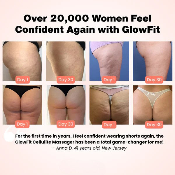 SilqueSculpt™ Cellulite Buster